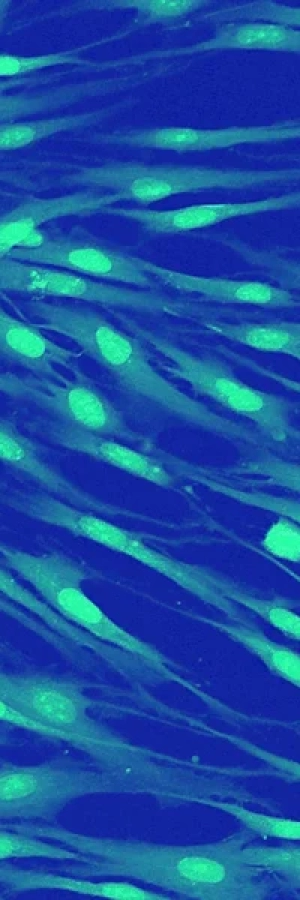 Knock-in Immortalized Cell Lines Knock-in Immortalized Cell Lines