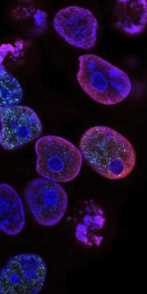 Arrayed gRNA Libraries